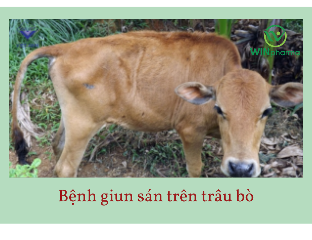 Bệnh giun sán