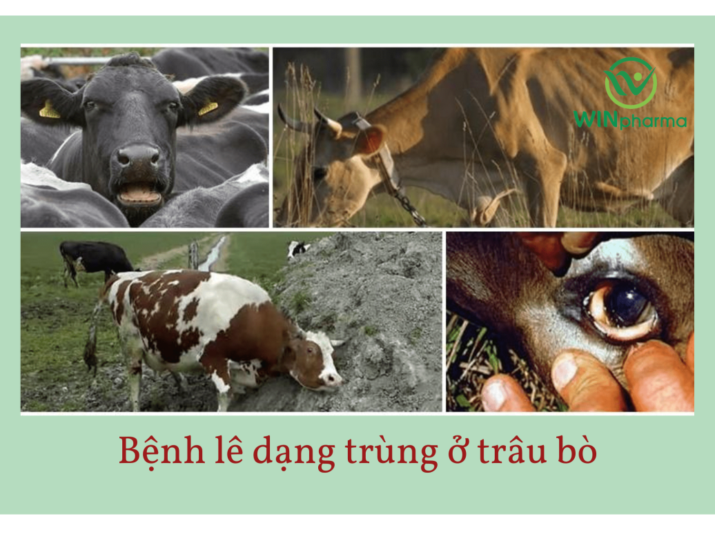 bệnh lê dạ trùng